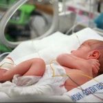 آمار تکان‌دهنده: 15 میلیون تولد زودرس در هر سال