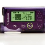 پانکراس مصنوعی برای تنظیم قند خون بیمار دیابتی